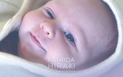 Ptose Palpebral Infantil Congênita – É Possível Operar Ainda na Infância?